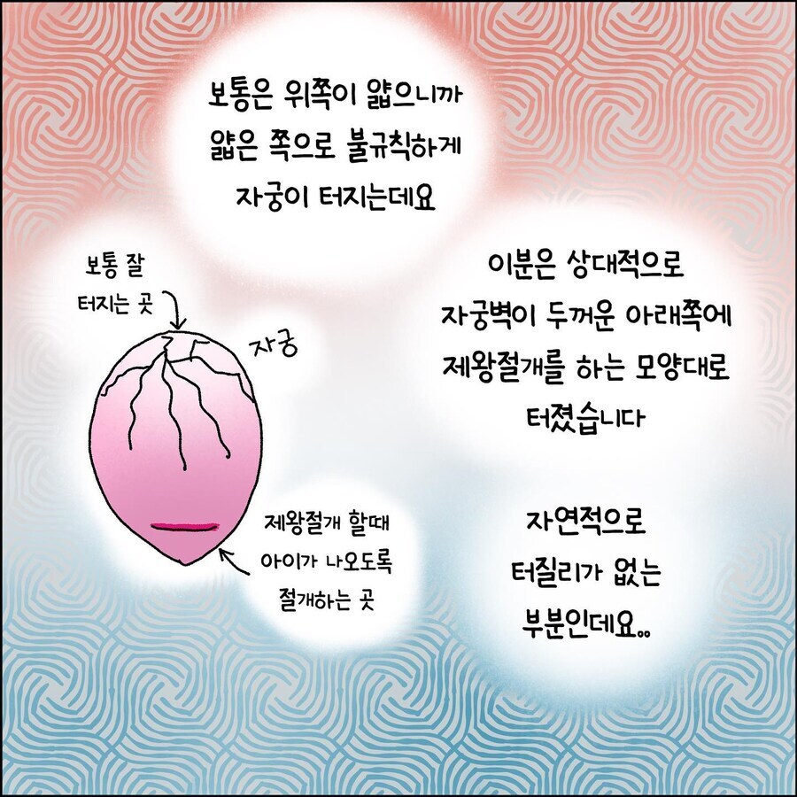 산부인과에서 출산 중 자궁파열 되는 만화_8.jpg
