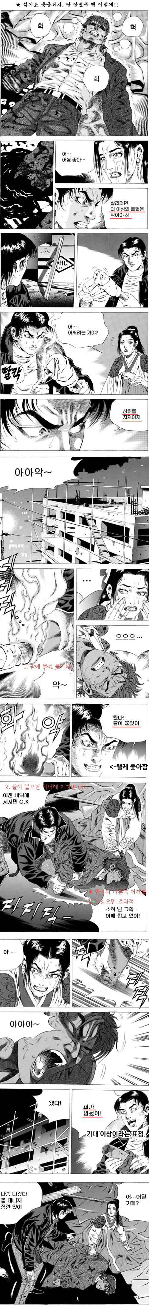 응급처치를 하는 방법_1.jpg