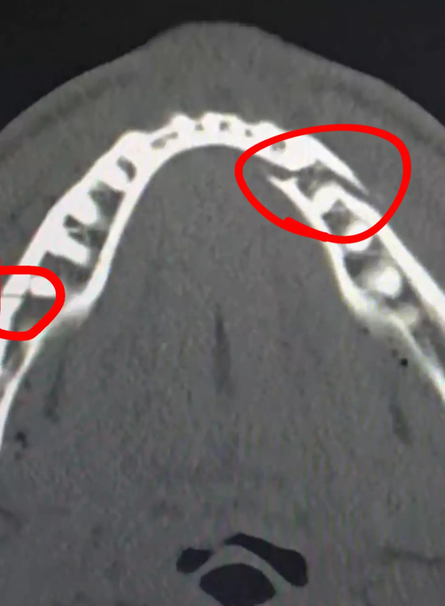 제이크 폴 vs 앤서니 조슈아 4컷 만화_4.webp