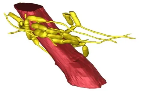 포켓몬)파라섹트 사실 죽은건 아님_1.webp