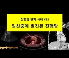 약혐) 현대 의학 기술의 한계