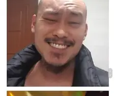 탈모는 포기하면 편하다