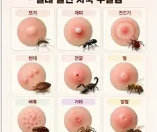 벌레 물린 자국 구별법