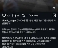 7000명중 1명.... 아무리 먹어도 살 안찌는 마른 유전자 발견됐다