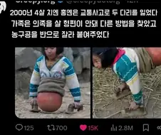 의족을 살 형편이 되지 않았던 가족.jpg