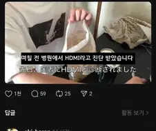 며칠 전 병원에서 HDMI라고 진단 받음