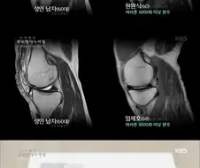 달리기 한다고 무릎이 망가지지 않는 이유.jpg