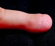 신기한 선천적 희귀병