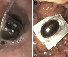약을 먹어도 효과가 없던 이유.jpg