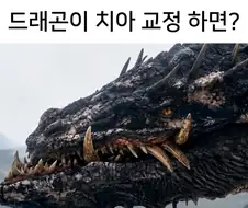 치아 교정을 하면 좋은 이유.jpg