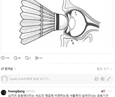 눈에 정통으로 맞았을 때 의외로 위험한 것.jpg