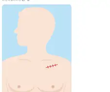 대중 목욕탕 갔다가 당황한 심장내과 의사