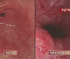 의외로 장애 질병