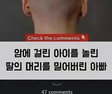 딸의 머리를 밀어버린 아빠.jpg