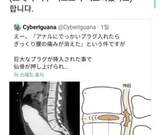 척추디스크 치료방법