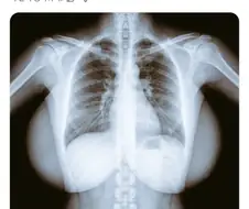 의외로 남자들이 무서워하는 엑스레이 사진.jpg