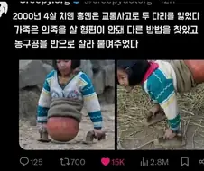 의족을 살 형편이 안됐던 가족들