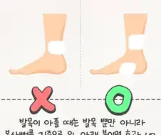 [습포일러]만약 발목이 아프다면