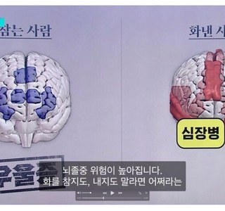 화를 참는 사람 뇌 vs 화를 내는 사람 뇌