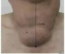 술을 물처럼 마시면 생기는 일