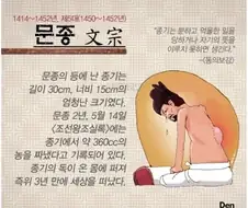 조선왕들이 종기만 났다하면 그냥 뒤지는 이유