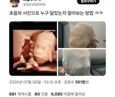 초음파 사진 누구 닮았는지 알아보는 방법