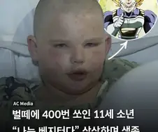 벌떼에 400번 쏘인 소년