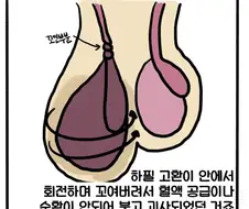 갑자기 한쪽 고환이 커지면 위험한 이유