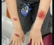 일본서 반응 좋은 반창고.jpe