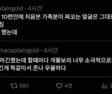 성형 했는데 의미가 없음