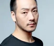 모발 이식 후 초 대박 난 배우