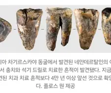 고대인류 갱신 정보. 5만년전에도 치과 치료 했을지도?