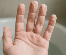 뉴어벤져스에 멤버의 극심한 직업병