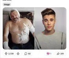 곰에게 습격받아 죽을 위기에서 뜨또 덕분에 목숨을 구한 러시아인