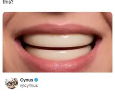 사람 이빨이 만화 이빨 같았다면?