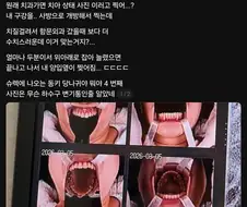 치과에서 수치 당한 사람