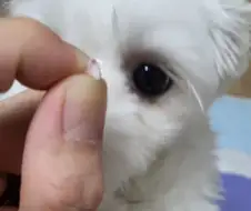 이게 환자분 이빨입니다