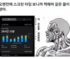 무식한 안과의사들은 모르는 경지가 있다....