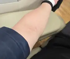 투구게를 보호해야 한다!!!