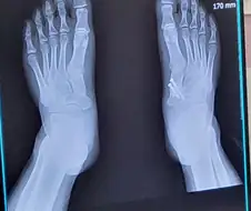 요오오오오즘 젊은 새끼들은 힘든 일을 안해서어어어