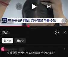 머리 꽉 묶은 포니테일, 탈모 불러 올 수도