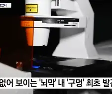 뇌) 뇌의 하수구 구멍이 코였다는데?