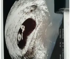 ↗됬다는 대학원생