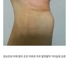 손목 탈구된 디씨인 본 응급의학과 교수