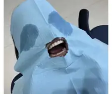 체외충격파 치료 받았는데.jpg