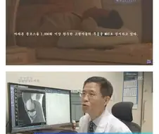 마라톤 베테랑들의 충격적인 무릎 상태
