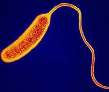 콜레라를 극복하는 방법