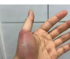 너무 신나게 논 대가