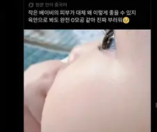 아기의 피부가 백옥같이 뽀얀 이유.twit