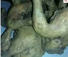 천연 위고비